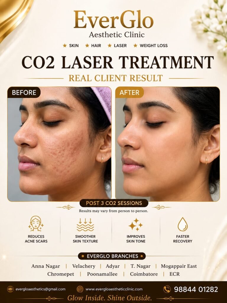 CO2 Laser Treatment