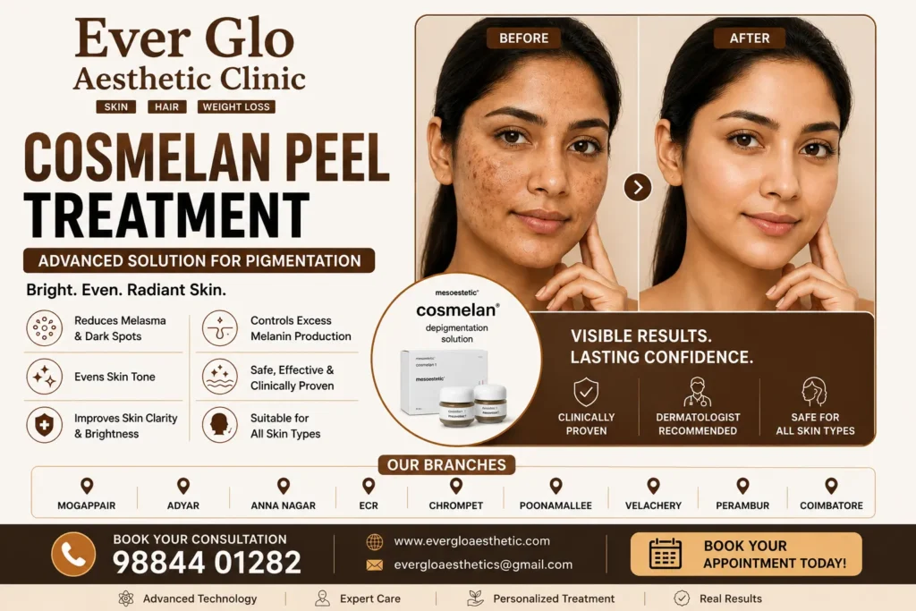 cosmelan peel treatment