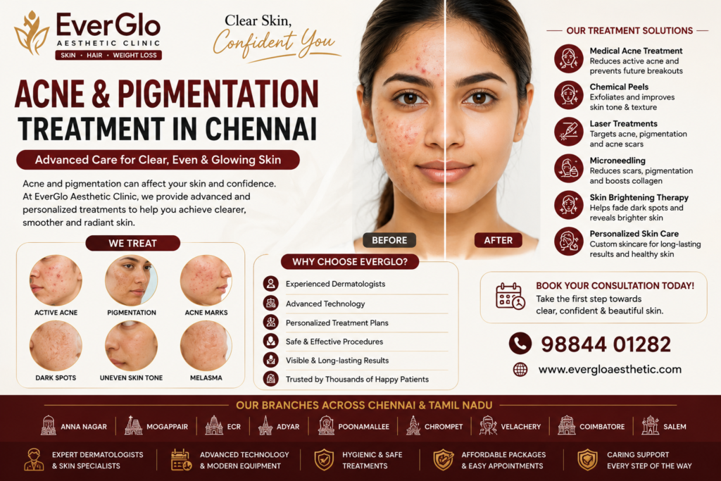 Acne Pigmentation treatment