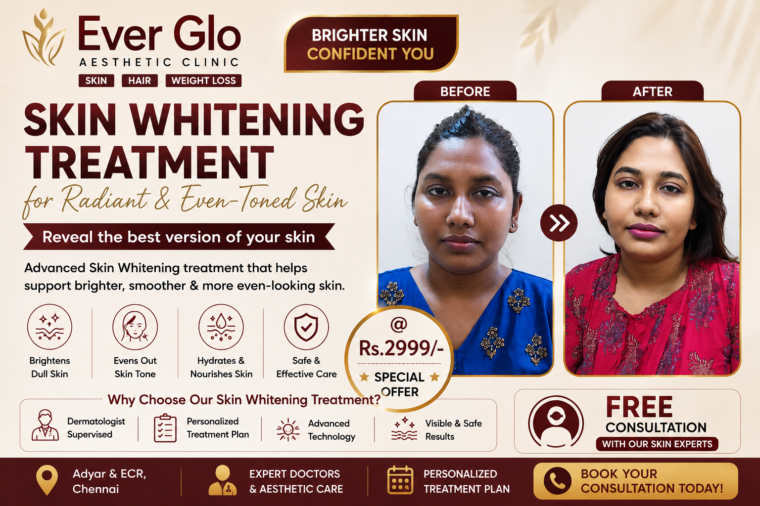 Iv skin Treatment in adyar
