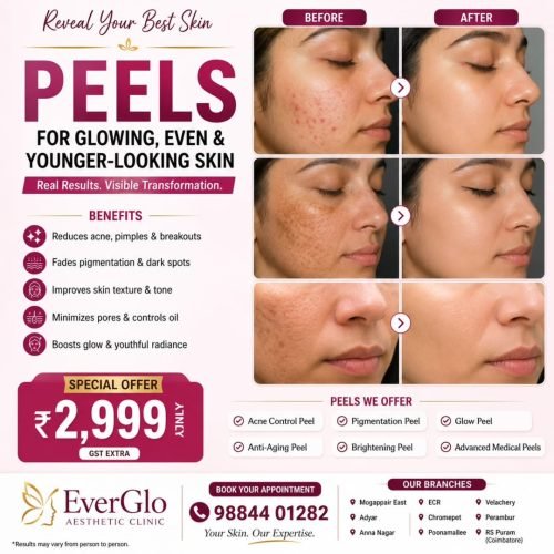 Peel Treatment