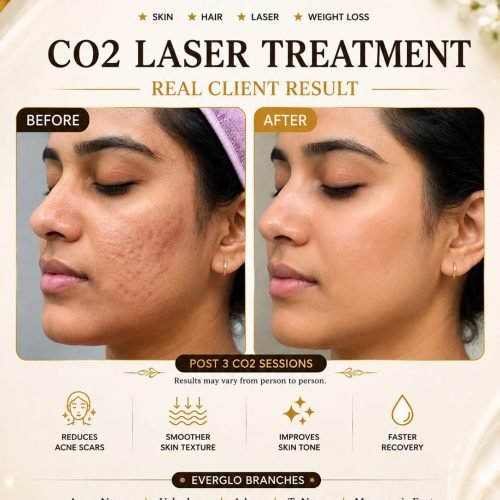 CO2 Laser Treatment